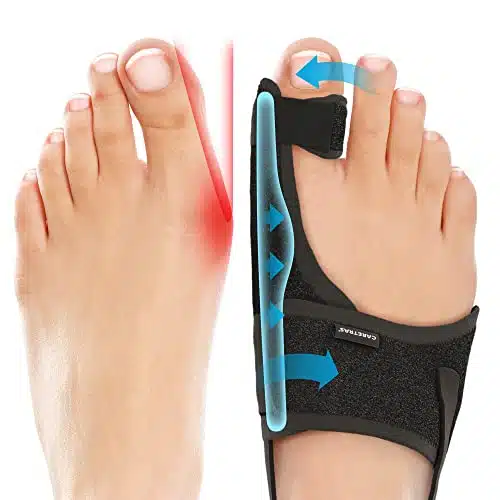 Caretras Bunion Corrector, Orthopedic Bunion Splint, Big Toe Separator Pain Relief, Non Surgical Hallux Valgus Correction, Hammer Toe Straightener, Day Night Support (Simple Elegant (Count))